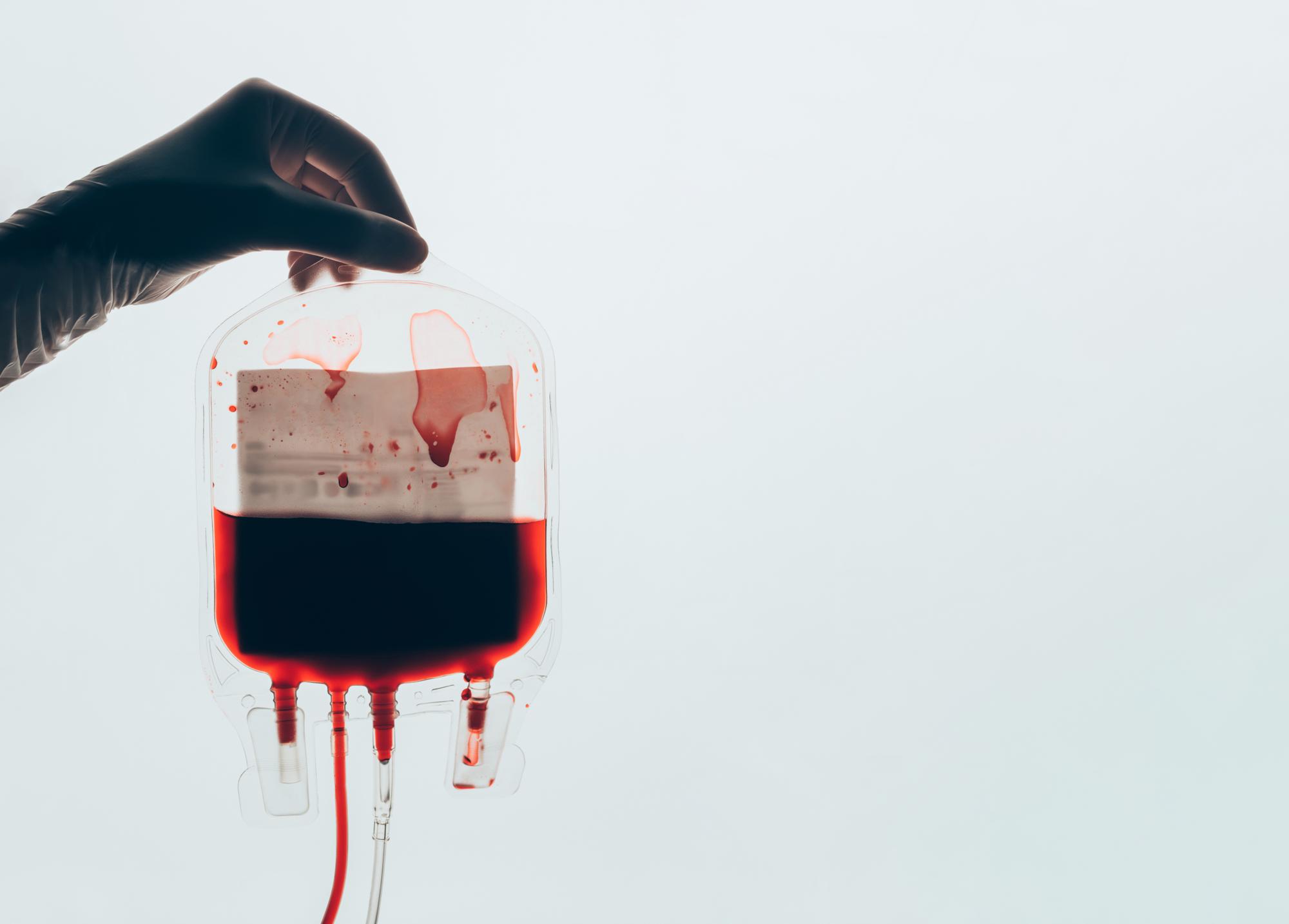 cropped shot of doctor holding plastic bag of blood for transfusion isolated on white