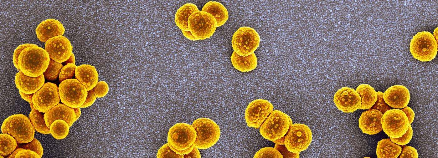 Le staphylocoque doré résistant à la méticilline (MRSA en anglais) prospère en milieu hospitalier.