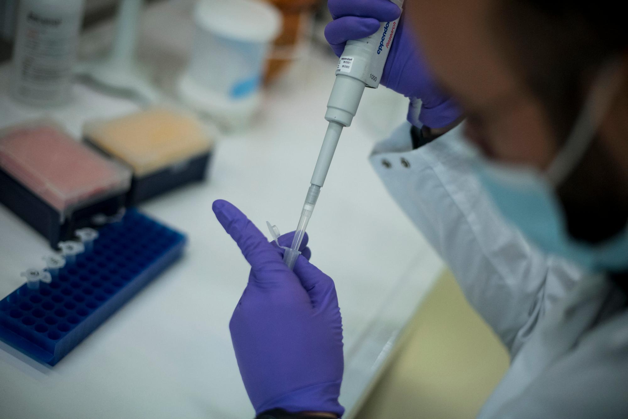 A laboratory worker prepares the wastewater from which the bacteria used to develop the phages necessary to fight these bacteria in the Pherecydes Pharma laboratory, in Romainville near Paris, on November 8, 2021. (Photo by JULIEN DE ROSA / AFP)