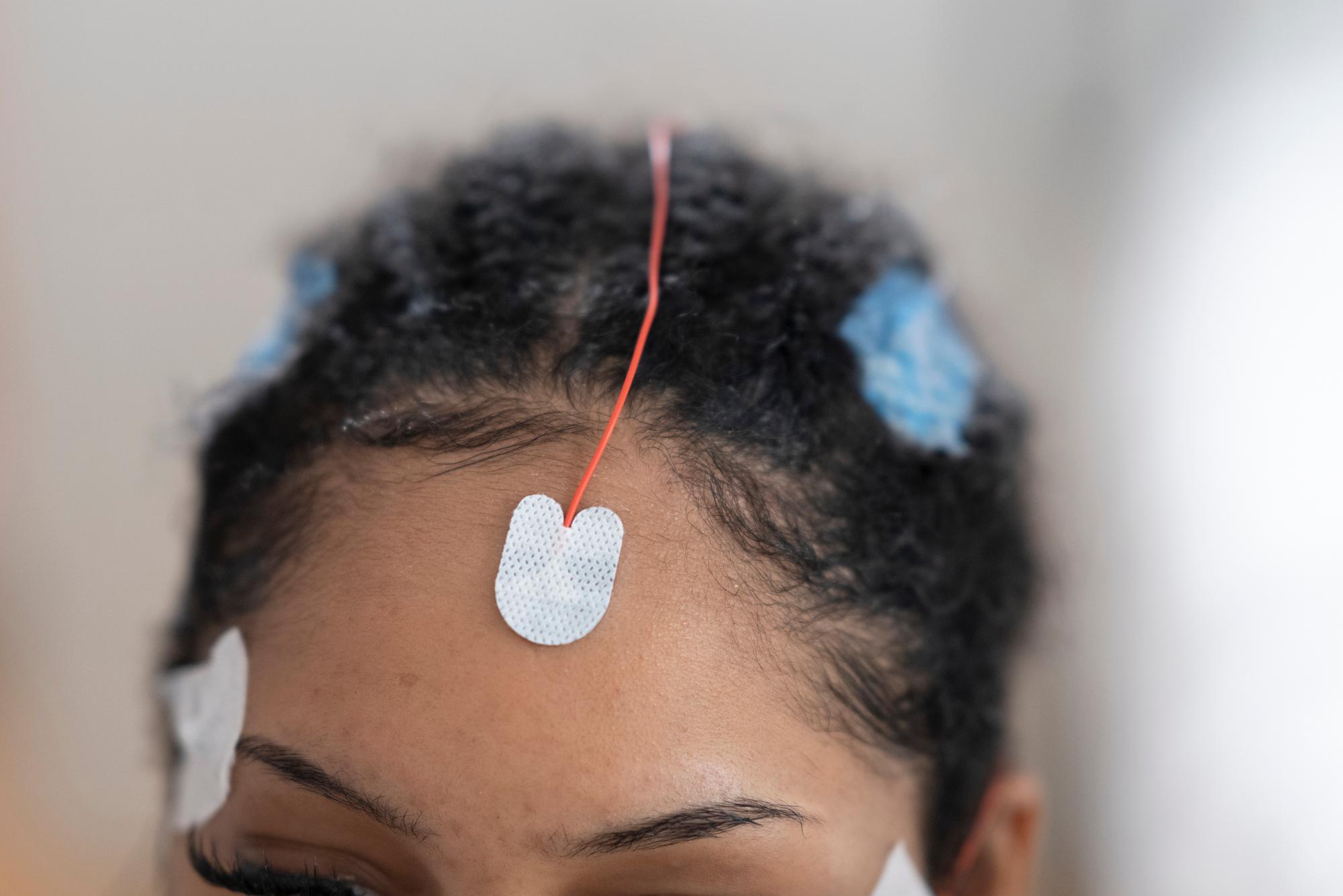 Les electrodes de mesure detectent de nombreux parametres qui affectent le sommeil d une patiente du centre du sommeil au Centre hospitalier universitaire vaudois (CHUV), lundi 22 aout 2022 a Lausanne. Pendant le sommeil, les electrodes mesurent tous les mouvements du corps, la respiration, les battements du cœur et les flux cerebraux et les transmettent en permanence au bureau de surveillance. (KEYSTONE/Gaetan bally)