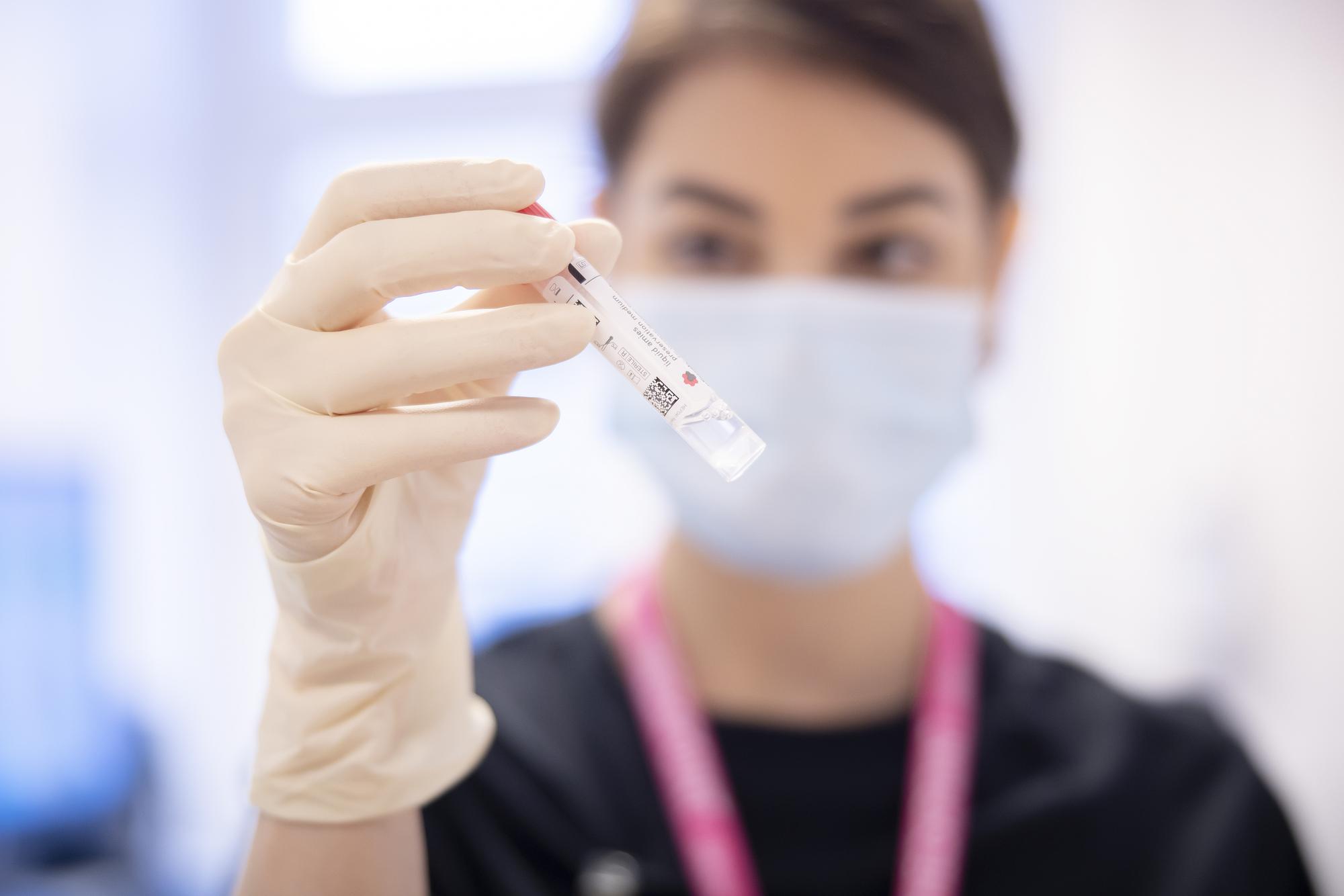 Eine Mitarbeiterin haelt einen PCR Abstrich fuer Chlamydien und Gonokokken im Checkpoint Zuerich, einem Gesundheitszentren fuer HIV und andere sexuell uebertragbare Infektionen, am Mittwoch, 17. November 2021 in Zuerich. Als erste Schweizer Stadt plant Zuerich für bestimmte Bevoelkerungsgruppen Gratistests zur Praevention von sexuell uebertragbaren Infektionen zur Verfuegung zu stellen. (KEYSTONE/Michael Buholzer)