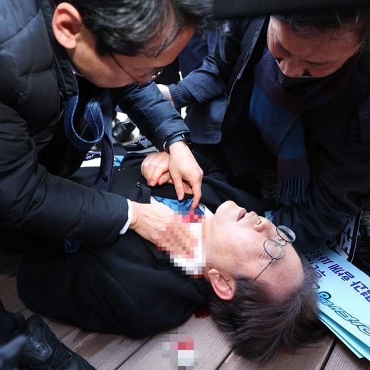 South Korean opposition party leader Lee Jae-myung is attended to after being attacked in Busan on January 2, 2024. South Korean opposition party leader Lee Jae-myung was attacked on January 2, while talking to reporters in the port city of Busan, Yonhap news agency reported. (Photo by YONHAP / AFP) / - South Korea OUT / NO ARCHIVES - RESTRICTED TO SUBSCRIPTION USE IMAGE PIXELATED AT SOURCE
