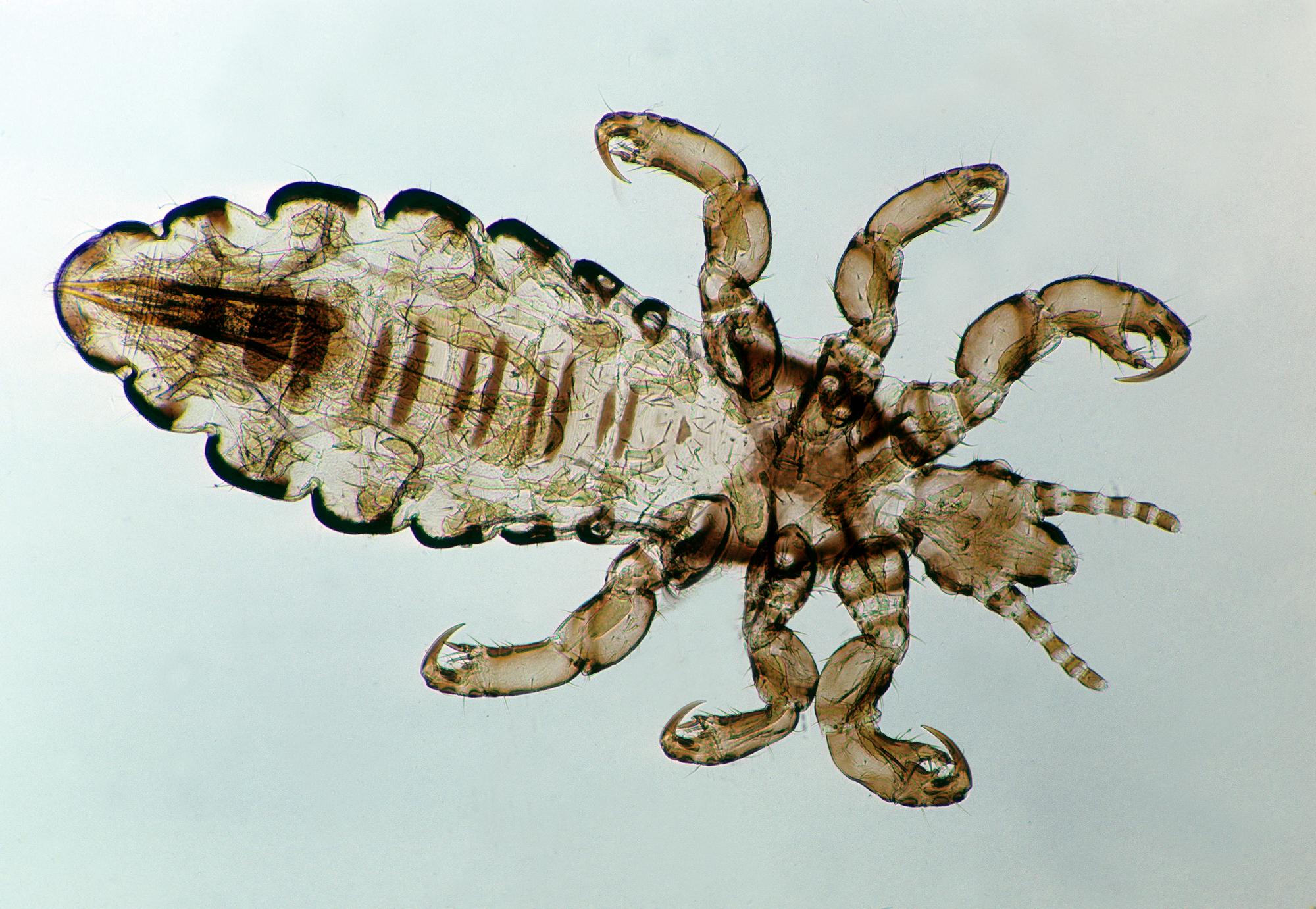 Head Louse of Man (Pediculus humanus capitis) 10X at 35mm. Lives in the fine hair of the head. Appendages are adapted for grasping. Blood sucking insects without wings.